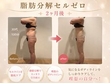 エステティックサロン フェアリー(ESTHETIC SALON FAIRLY)の雰囲気(夏直前!脂肪分解セルゼロで理想的なスリムボディへ!)