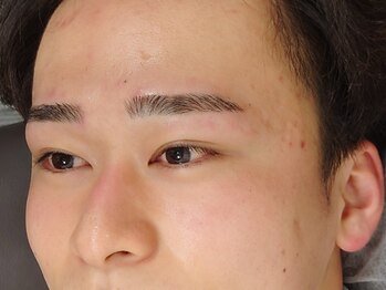 ミキ(MIKI)/【眉毛ワックス脱毛】