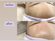 ハイク バイ ジェン(HIKE by gen.)/ フェイシャルワックス