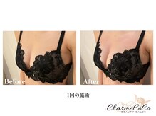 シャルムココ 蔵前店(CharmeCoCo)/お客様Before→After