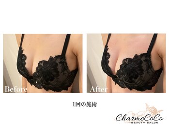 シャルムココ 蔵前店(CharmeCoCo)/お客様Before→After