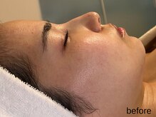 サロン ド エメ(salon de aimer)/【Before】本格エイジングケアに