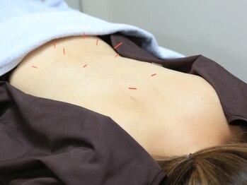 あゆみ鍼灸マッサージ