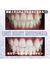 ライトビューティー 本八幡店(LIGHT BEAUTY)/素敵なお色の歯！