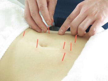 白記漢方堂鍼灸院(HAKU KI)の写真/【女性のお悩みの実績多数！】女性のお悩みに特化した鍼灸施術