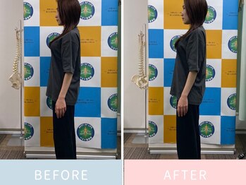 ベスト整骨院/首の歪みがスッキリ！！