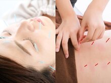 オレンジ鍼灸整体院