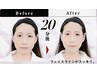 【新メニュー】誰でもOK！刺さない美容鍼＋お灸で腸活セット◎ 計30分　¥4000