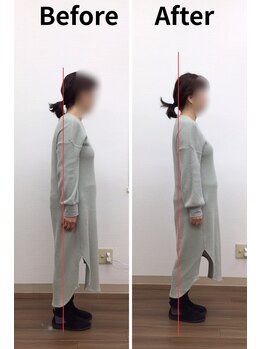 リライフ/Before/After