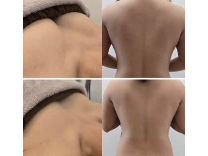 クレビア(CREBIA)の写真