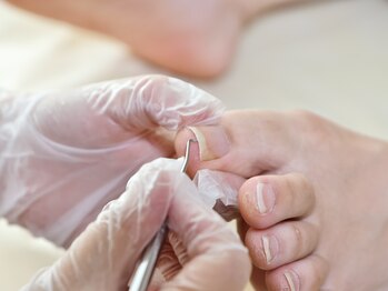 爪下の角質ケア