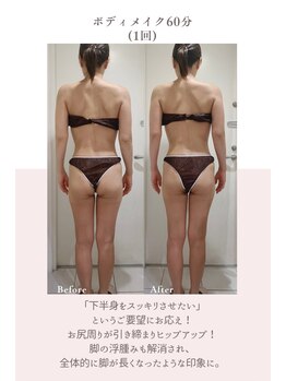 トゥインクル 麻布(twinkle)/南麻布/小顔矯正/勝山式美容矯正