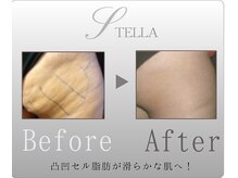 ステラ(STELLA)/下半身プレミアムの効果