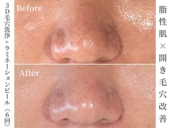 ゼアー(THERE FY.)/men'sの肌改善もお任せ!