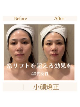 スカーレット 北参道(Scarlett)/Scarlett式小顔矯正