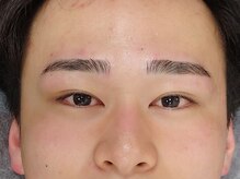 ミキ(MIKI)/【眉毛ワックス脱毛】