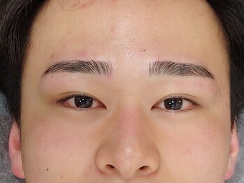 ミキ(MIKI)/【眉毛ワックス脱毛】