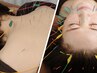 全身鍼×美容鍼しっかりコース