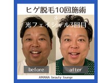 アマナ(AMANA)