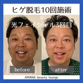 アマナ(AMANA)