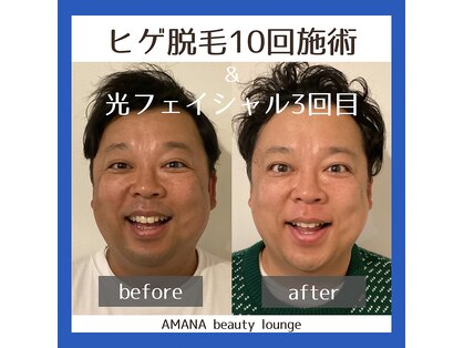 アマナ(AMANA)の写真