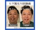 アマナ(AMANA)の写真