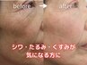 【8.9月限定】　エイジングケアコース　　通常新規価格￥11,000→6,500