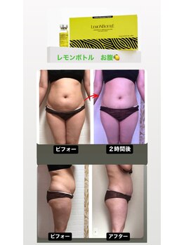 サロン ド ルルアス(Salon de LuLuas)/レモンボトルお腹10ミリリットル