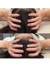 ケリービューティーサロン(kelly beauty salon)/浮腫みで頭のサイズが変わります