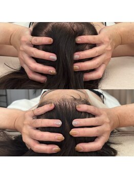 ケリービューティーサロン(kelly beauty salon)/浮腫みで頭のサイズが変わります