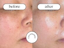 ユヌランコント 岐阜店(Une rencontre)/ハーブ＆ジュエリーピーリング