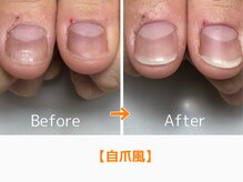 レアム/自爪のような仕上がり。