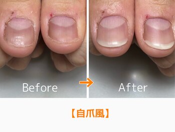 レアム/自爪のような仕上がり。