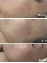 メディカルエース(MedicalAce)/スポット