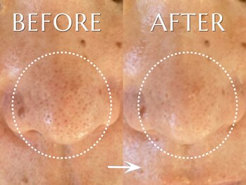 神門 メディカルラボ MEILI院(MedicalLab)/40代 | 女性 | ハーブピーリング