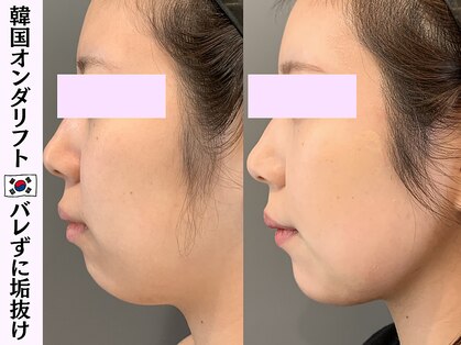 オンダリフト東京 大阪梅田店の写真