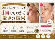 ラヴィアンローズ 岐阜本店(La vie en Rose)の雰囲気(イロンハーブピーリング(6回施術))