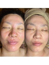 キラディ(KILADY)/肌質感でお悩みの方にも必見！