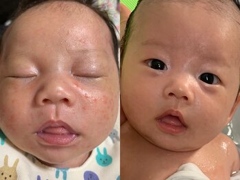 エステティックサロン リノリノ(Lino Lino)/アクア部門★セミファイナル受賞