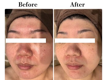 フレイヤ(FREYA)/ララピールBefore→After