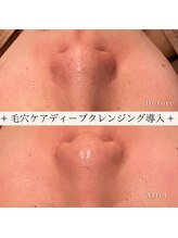 カオヤ プラス(Kaoya plus)/毛穴ケアディープクレンジング◎