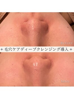 カオヤ プラス(Kaoya plus)/毛穴ケアディープクレンジング◎