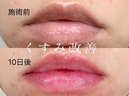 カルム(Calme)の写真