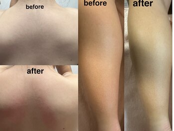 ネイル バイ エン(Nail by EN)/中高生もすぐに結果が♪