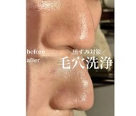 トータルエステサロン ポイント(POINT)