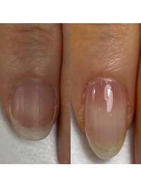 自爪育成／小さい爪