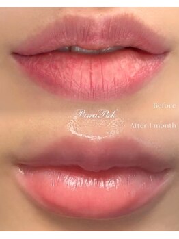 アップオー 小倉店(up・O)/くすんだ唇を本来の色に！