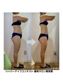 ルミナ ビューティーアンドリラックス(LUMINA Beauty&Relax)の写真/【ハイパーナイフ正規認定サロン】受賞サロンで最高峰の結果！【10日以内の再来店で痩身全コース15％OFF】