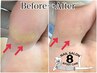 《フット》足爪カットケア＋足指角質除＋足爪磨き