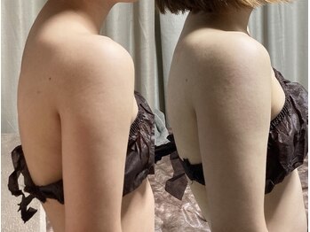 リラチル(relachill)/筋膜リリース（上半身）